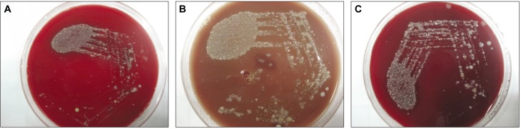 Blood-and-chocolate-agar-(1).jpg
