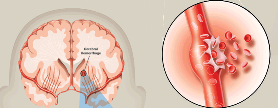 đot-quy-stroke.png